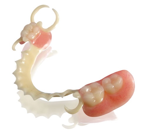 Ultralight acetal partial with six teeth spread across a pink artificial gum